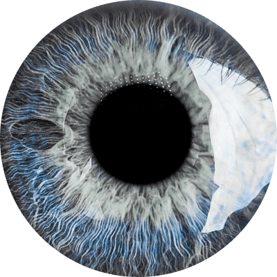 Precision Vision London Eye Surgery Clinic