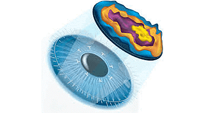 Advanced Wavefront Technology