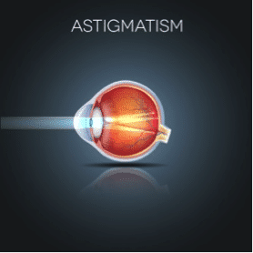 astigmatism