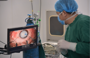 Can You Get Cataract Surgery After LASIK