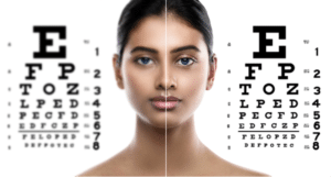 Laser eye surgery effects