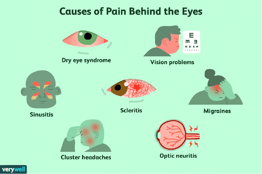 How laser eye surgery helps relieve headache symptoms