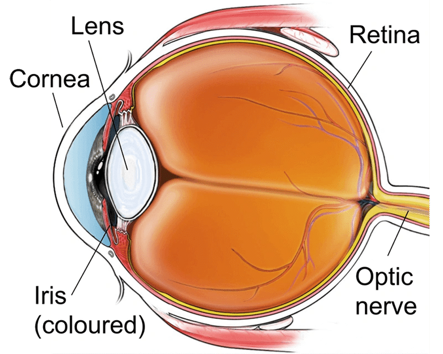 The Permanence of Corneal Implants- What to Expect